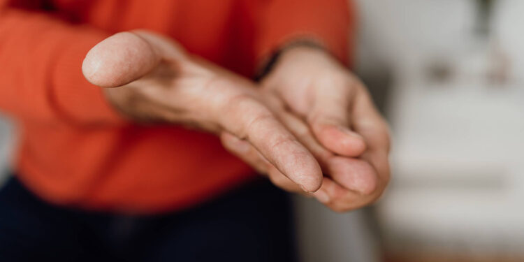 “Like a Miracle”: High-Tech Surgery Put a Halt to Music Instructor’s Hand Tremors