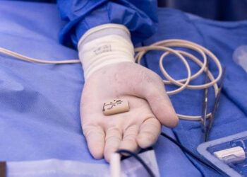 A Tiny Heart, A Big Fight: Baby Michael’s Historic Surgery